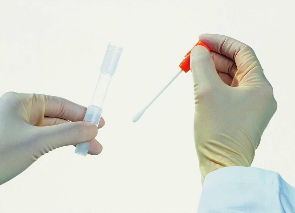 Analysis collected to detect chronic prostatitis