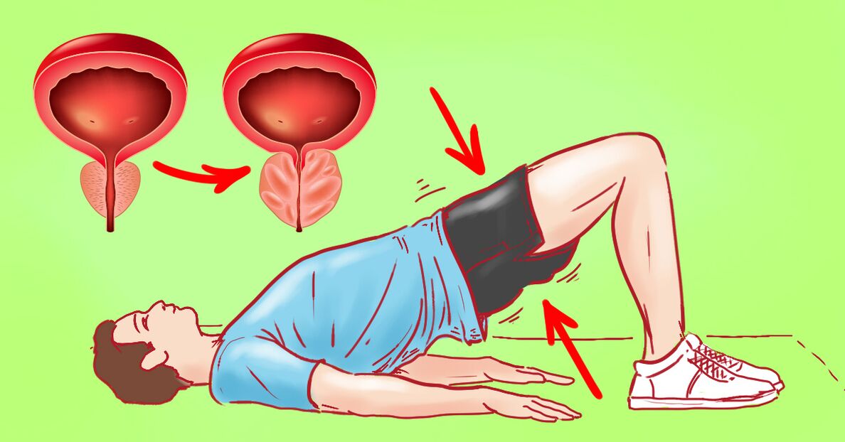 Treatment exercises for chronic prostatitis