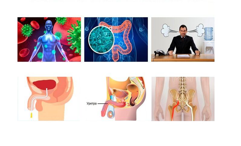 cause of prostatitis