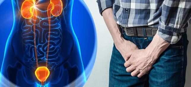 Prostatitis (inflammation of the prostate gland) in men